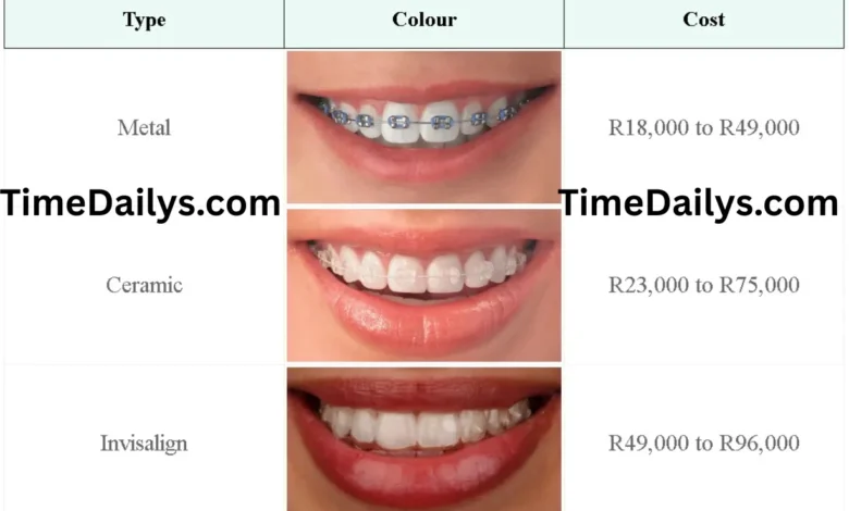 How Much Are Braces