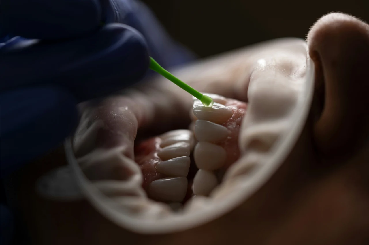 Crest Whitestrips vs whitening toothpaste